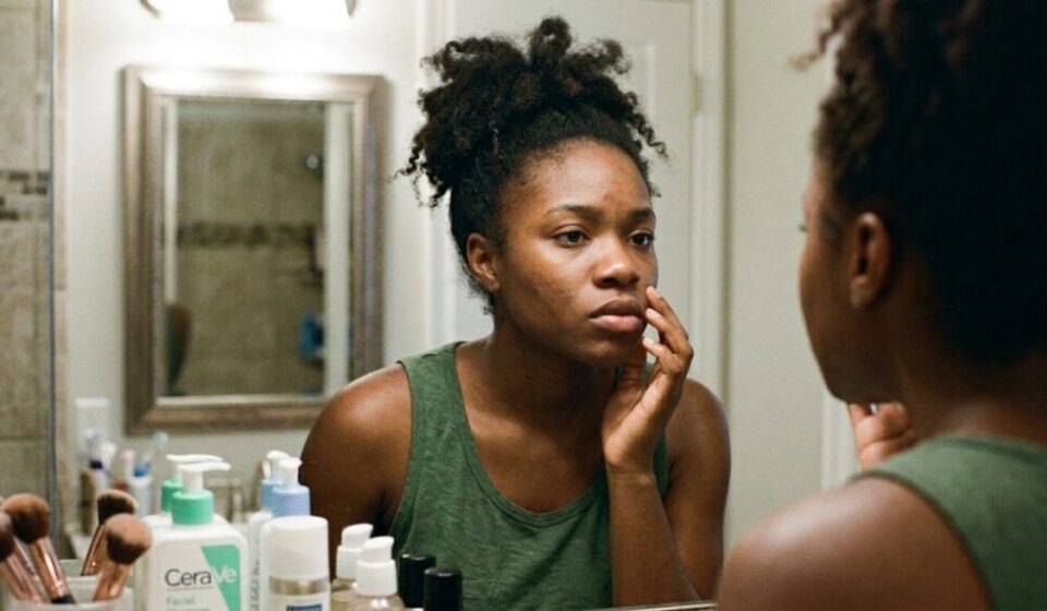 Teenage Acne Is Normal, but Your Skincare Routine Could Be Making It Worse